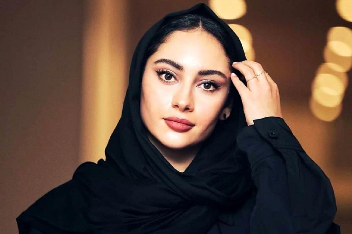 تزریق های گوناگون روی صورت ترلان پروانه | چهره ترلان پروانه به شدت تغییر کرد