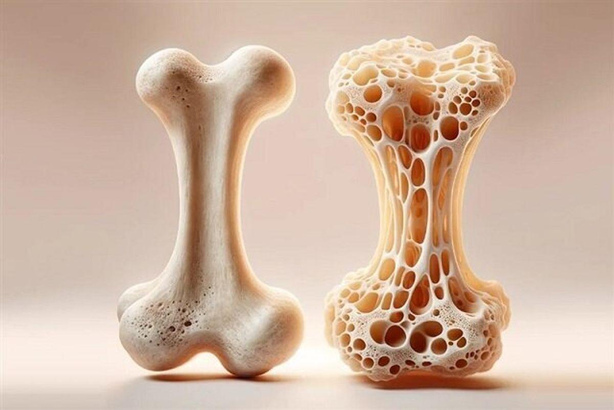 این نوشیدنی استخوان زنان را پوک می‌کند