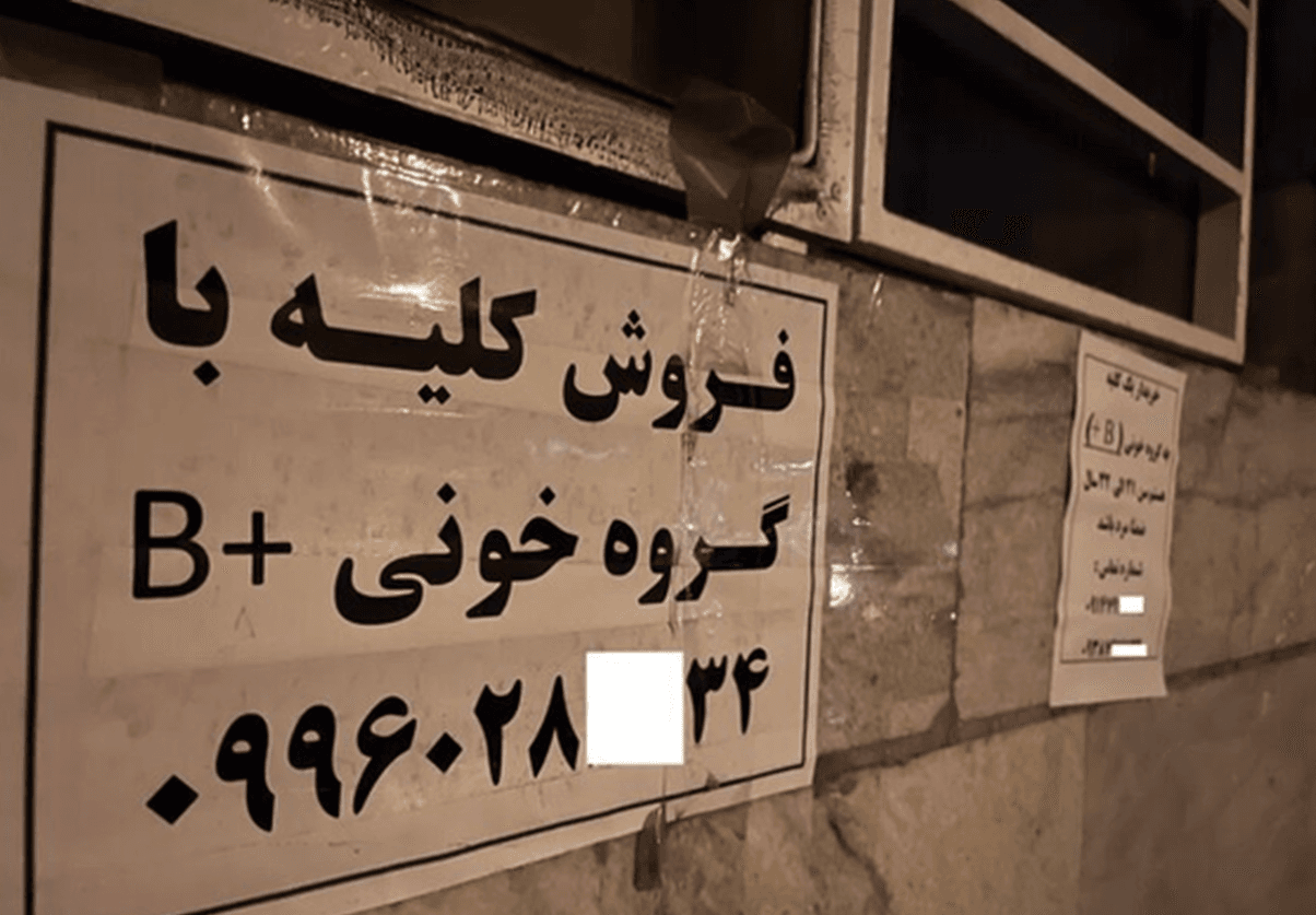 خبر تکان‌دهنده از فروش کلیه ۷۰ میلیاردی در تهران!