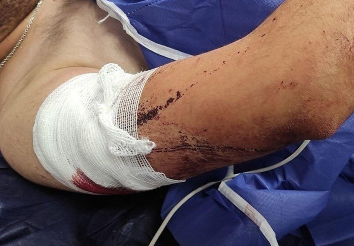 زورگیری از پسر دانشجو در پارک شهر گرگان