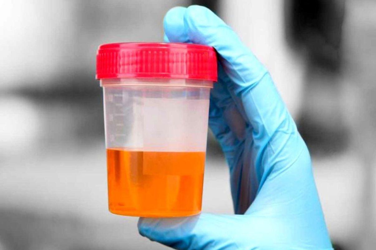 دلیل بوی بد ادرار