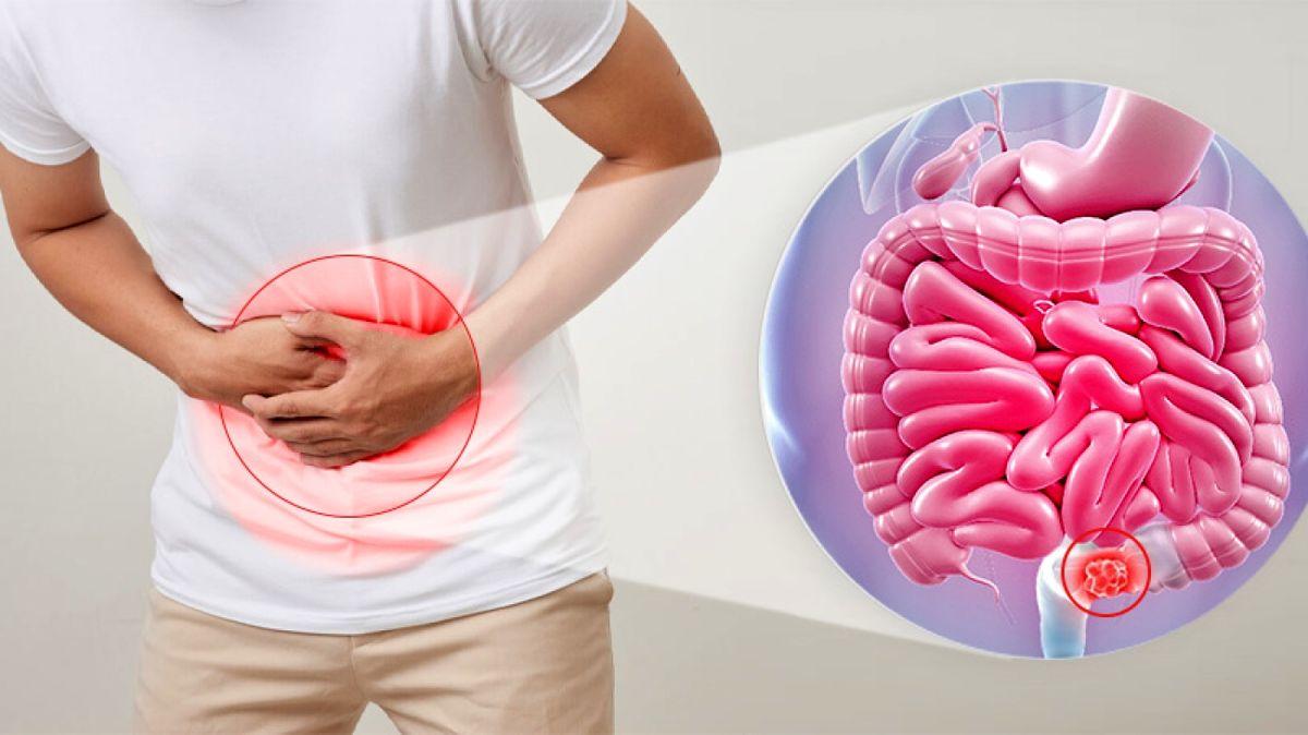 یک معجون طلایی برای درمان یبوست و تخلیه کامل روده ها