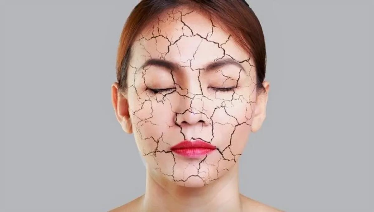 راه های پاکسازی پوست خشک| چگونه پوست خشک را احیا کنیم؟