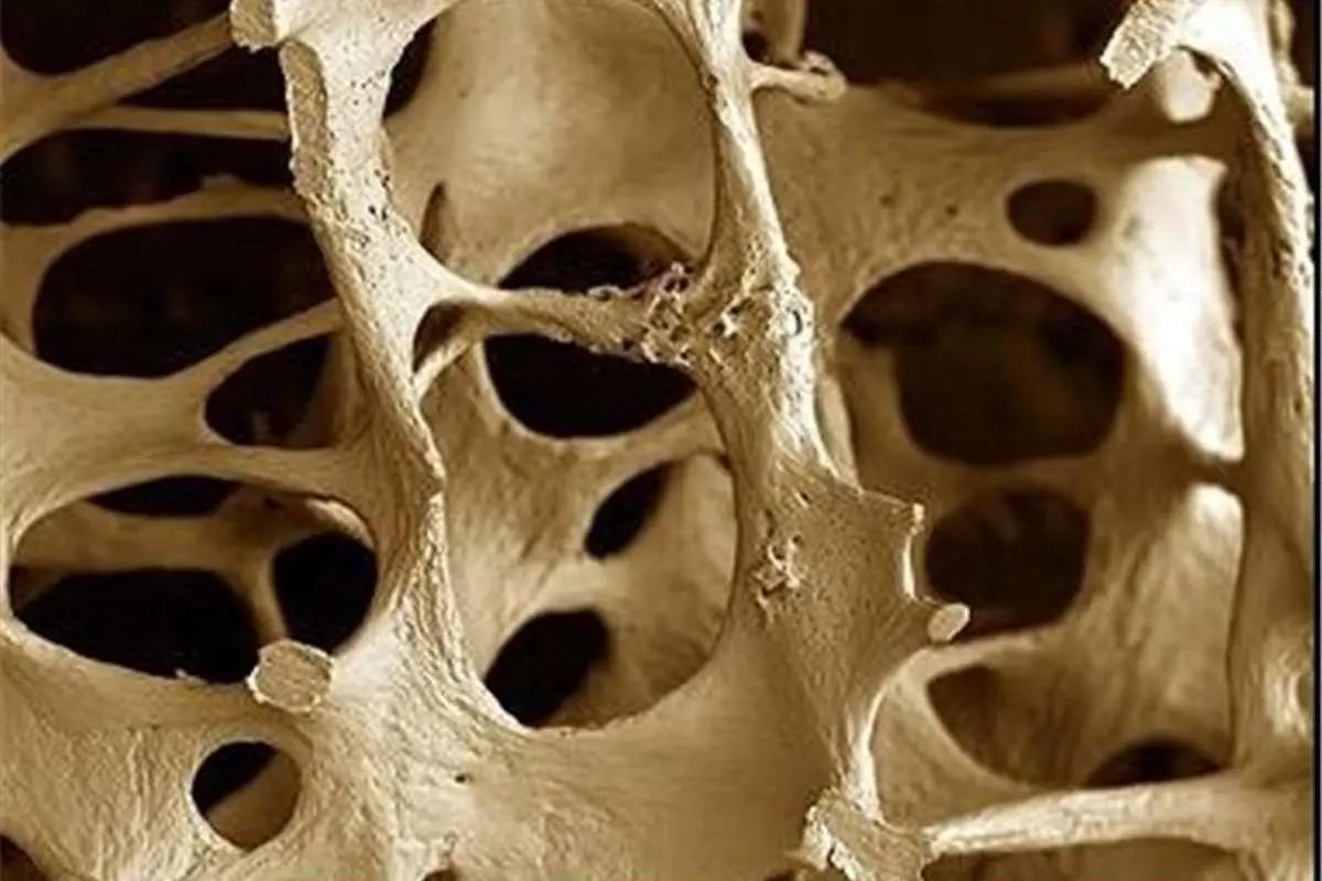 بهترین ویتامینها برای تقویت استخوان کدامند؟