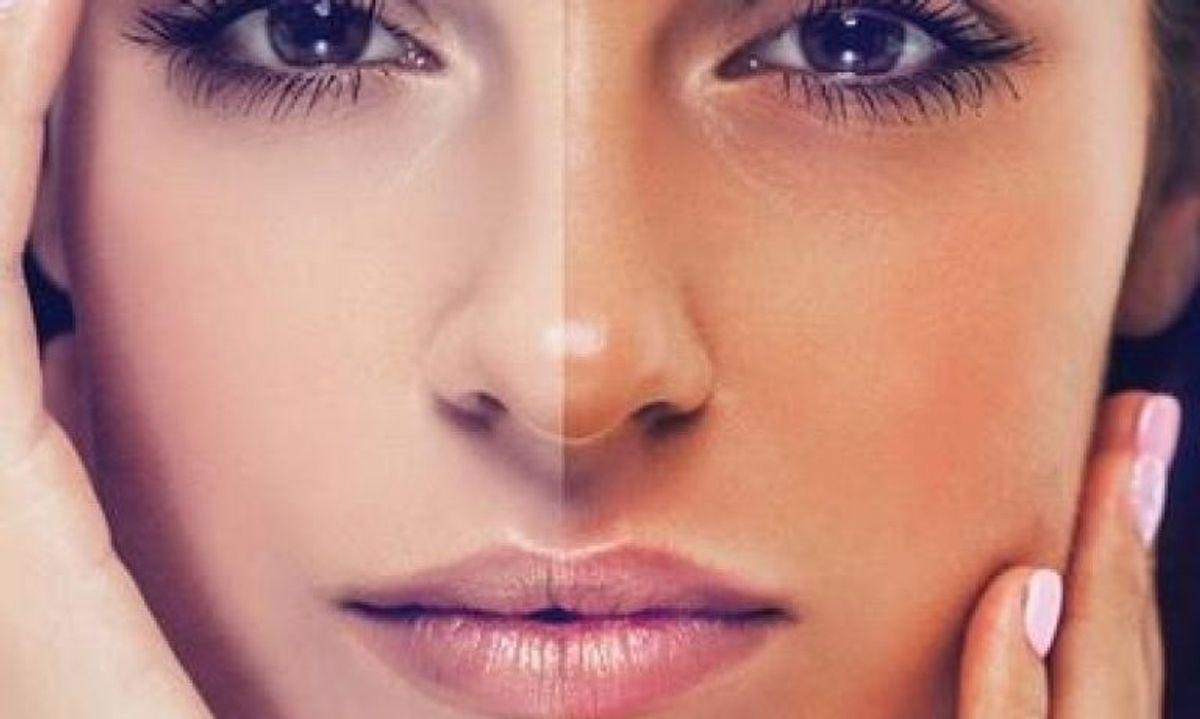 نکات مهم مراقبت از پوست بعد از برنزه کردن | چطور ماندگاری و سلامت پوست را حفظ کنیم؟